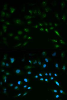 NFE2L2 / NRF2 Antibody - Immunofluorescence analysis of HeLa cell using NFE2L2 antibody. Blue: DAPI for nuclear staining.