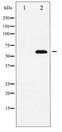 NFE2L2 / NRF2 Antibody - Western blot of Nrf2 expression in HUVEC whole cell lysates,The lane on the left is treated with the antigen-specific peptide.