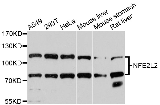 NFE2L2 / NRF2 Antibody - Western blot analysis of extracts of various cell lines, using NFE2L2 antibody at 1:3000 dilution. The secondary antibody used was an HRP Goat Anti-Rabbit IgG (H+L) at 1:10000 dilution. Lysates were loaded 25ug per lane and 3% nonfat dry milk in TBST was used for blocking. An ECL Kit was used for detection and the exposure time was 60s.