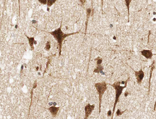 NFE2L2 / NRF2 Antibody - 1:100 staining human brain tissue by IHC-P. The tissue was formaldehyde fixed and a heat mediated antigen retrieval step in citrate buffer was performed. The tissue was then blocked and incubated with the antibody for 1.5 hours at 22°C. An HRP conjugated goat anti-rabbit antibody was used as the secondary.