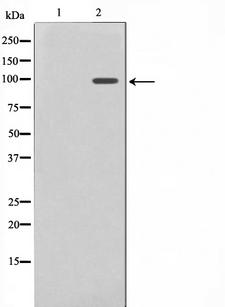 NFE2L2 / NRF2 Antibody - Western blot analysis on HuvEc cell lysates using Nrf2 antibody. The lane on the left is treated with the antigen-specific peptide.