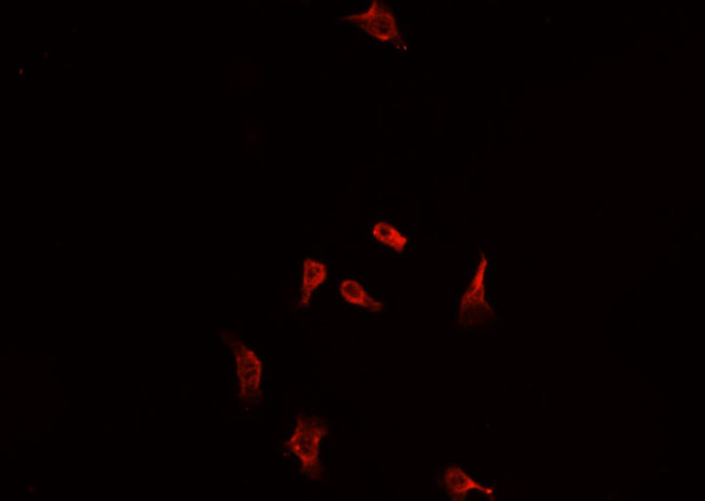 NFE2L2 / NRF2 Antibody - Staining HuvEc cells by IF/ICC. The samples were fixed with PFA and permeabilized in 0.1% Triton X-100, then blocked in 10% serum for 45 min at 25°C. The primary antibody was diluted at 1:200 and incubated with the sample for 1 hour at 37°C. An Alexa Fluor 594 conjugated goat anti-rabbit IgG (H+L) Ab, diluted at 1/600, was used as the secondary antibody.