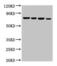 NFE2L3 Antibody - Western Blot Positive WB detected in: Hela whole cell lysate, U87 whole cell lysate, 293T whole cell lysate, Jurkat whole cell lysate All lanes: NFE2L3 antibody at 3µg/ml Secondary Goat polyclonal to rabbit IgG at 1/50000 dilution Predicted band size: 77 kDa Observed band size: 77 kDa