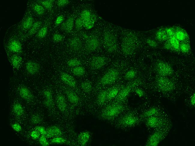 NFE2L3 Antibody - Immunofluorescence staining of NFE2L3 in Caco2 cells. Cells were fixed with 4% PFA, permeabilzed with 0.3% Triton X-100 in PBS, blocked with 10% serum, and incubated with rabbit anti-Human NFE2L3 polyclonal antibody (dilution ratio 1:200) at 4°C overnight. Then cells were stained with the Alexa Fluor 488-conjugated Goat Anti-rabbit IgG secondary antibody (green). Positive staining was localized to Nucleus and Cytoplasm.