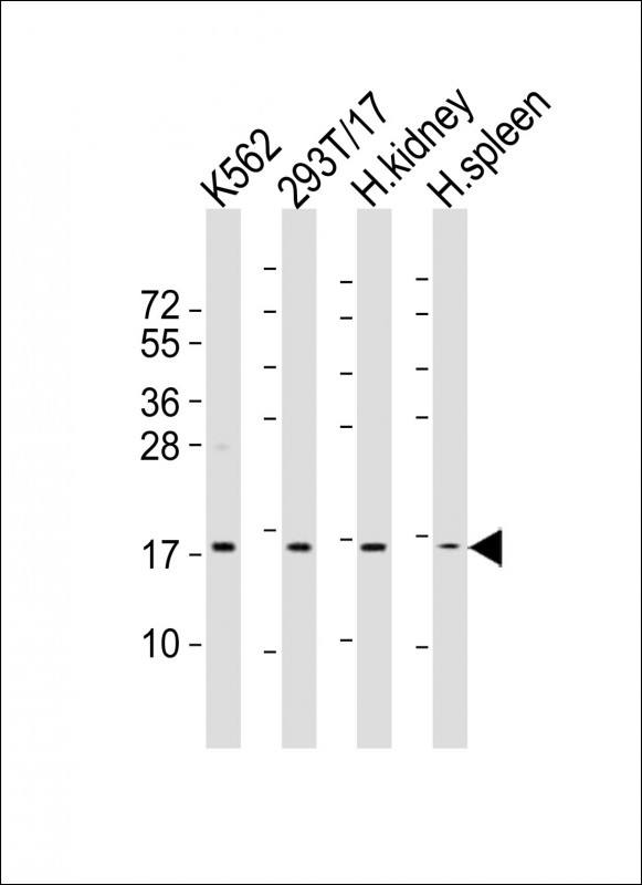 NFE4 / NF-E4 Antibody - All lanes : Anti-NFE4 Antibody at 1:2000 dilution Lane 1: K562 whole cell lysates Lane 2: 293T/17 whole cell lysates Lane 3: human kidney lysates Lane 4: human spleen lysates Lysates/proteins at 20 ug per lane. Secondary Goat Anti-Rabbit IgG, (H+L), Peroxidase conjugated at 1/10000 dilution Predicted band size : 19 kDa Blocking/Dilution buffer: 5% NFDM/TBST.