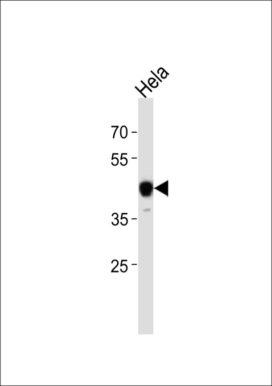 NFI / NFIC Antibody - NFIC Antibody western blot of HeLa cell line lysates (35 ug/lane). The NFIC antibody detected the NFIC protein (arrow).