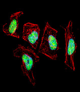 NFI / NFIC Antibody - Fluorescent confocal image of HeLa cell stained with NFIC Antibody. HeLa cells were fixed with 4% PFA (20 min), permeabilized with Triton X-100 (0.1%, 10 min), then incubated with NFIC primary antibody (1:25, 1 h at 37°C). For secondary antibody, Alexa Fluor 488 conjugated donkey anti-rabbit antibody (green) was used (1:400, 50 min at 37°C). Cytoplasmic actin was counterstained with Alexa Fluor 555 (red) conjugated Phalloidin (7units/ml, 1 h at 37°C). Nuclei were counterstained with DAPI (blue) (10 ug/ml, 10 min). NFIC immunoreactivity is localized to nucleus significantly.