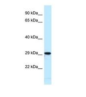 NFI / NFIC Antibody - Western blot of Mouse Heart. Nfic antibody dilution 1.0 ug/ml.  This image was taken for the unconjugated form of this product. Other forms have not been tested.