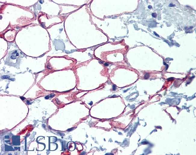 NFI / NFIC Antibody - Anti-NFIC antibody IHC of normal human adrenal (adipocytes). Immunohistochemistry of formalin-fixed, paraffin-embedded tissue after heat-induced antigen retrieval. Antibody concentration 5 ug/ml.  This image was taken for the unconjugated form of this product. Other forms have not been tested.