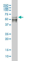 NFI / NFIC Antibody - NFIC monoclonal antibody (M01), clone 1C12-2A2 Western blot of NFIC expression in A-431.