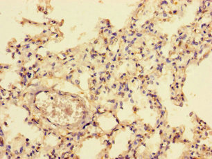 NFI / NFIC Antibody - Immunohistochemistry of paraffin-embedded human lung tissue using NFIC Antibody at dilution of 1:100