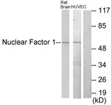 NFIA+NFIB+NFIC+NFIX Antibody - Western blot analysis of lysates from rat brain and HUVEC cells, using Nuclear Factor 1 Antibody. The lane on the right is blocked with the synthesized peptide.