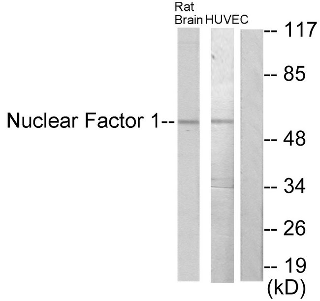 NFIA+NFIB+NFIC+NFIX Antibody - Western blot analysis of lysates from rat brain and HUVEC cells, using Nuclear Factor 1 Antibody. The lane on the right is blocked with the synthesized peptide.