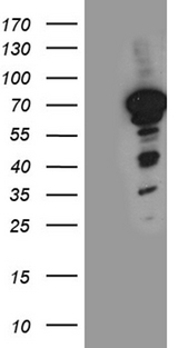 NFIA / Nuclear Factor 1 Antibody - HEK293T cells were transfected with the pCMV6-ENTRY control. (Left lane) or pCMV6-ENTRY NFIA. (Right lane) cDNA for 48 hrs and lysed. Equivalent amounts of cell lysates. (5 ug per lane) were separated by SDS-PAGE and immunoblotted with anti-NFIA. (1:2000)