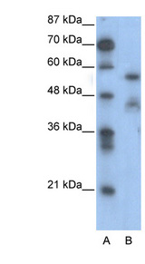 NFIA / Nuclear Factor 1 Antibody - NFIA antibody Western blot of Jurkat lysate. This image was taken for the unconjugated form of this product. Other forms have not been tested.
