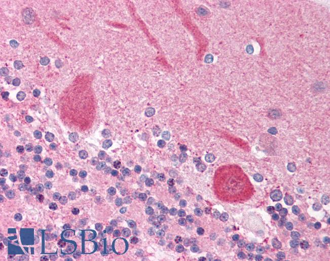 NFIA / Nuclear Factor 1 Antibody - Anti-NFIA antibody IHC of human brain, cerebellum. Immunohistochemistry of formalin-fixed, paraffin-embedded tissue after heat-induced antigen retrieval. Antibody concentration 5 ug/ml.  This image was taken for the unconjugated form of this product. Other forms have not been tested.