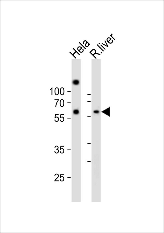 NFIA / Nuclear Factor 1 Antibody - Western blot of lysates from HeLa cell line, rat liver tissue lysate (from left to right) with NFIA Antibody. Antibody was diluted at 1:1000 at each lane. A goat anti-rabbit IgG H&L (HRP) at 1:10000 dilution was used as the secondary antibody. Lysates at 20 ug per lane.