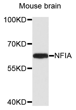 NFIA / Nuclear Factor 1 Antibody - Western blot analysis of extracts of mouse brain cells.