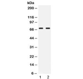 NFIA / Nuclear Factor 1 Antibody - Western blot testing of human 1) Jurkat and 2) COLO320 lysate with NFIA antibody at 0.5ug/ml. Predicted molecular weight ~56 kDa (unmodified), 60-70 kDa (phosphorylated).