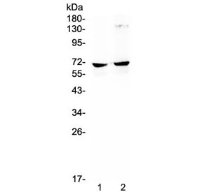 NFIA / Nuclear Factor 1 Antibody - Western blot testing of mouse 1) HEPA1-6 and 2) SP2/0 lysate with NFIA antibody at 0.5ug/ml. Predicted molecular weight ~56 kDa (unmodified), 60-70 kDa (phosphorylated).