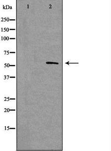 NFIA / Nuclear Factor 1 Antibody - Western blot analysis of extracts of rat brain cells using Nuclear Factor 1 antibody. The lane on the left is treated with the antigen-specific peptide.