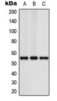 NFIA / Nuclear Factor 1 Antibody - Western blot analysis of NFIA expression in Jurkat (A); Raw264.7 (B); rat brain (C) whole cell lysates.