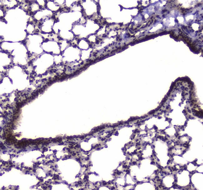 NFIB Antibody - IHC analysis of NFIB/NF1B2 using anti-NFIB/NF1B2 antibody. NFIB/NF1B2 was detected in paraffin-embedded section of mouse lung tissue . Heat mediated antigen retrieval was performed in citrate buffer (pH6, epitope retrieval solution) for 20 mins. The tissue section was blocked with 10% goat serum. The tissue section was then incubated with 1µg/ml rabbit anti-NFIB/NF1B2 Antibody overnight at 4°C. Biotinylated goat anti-rabbit IgG was used as secondary antibody and incubated for 30 minutes at 37°C. The tissue section was developed using Strepavidin-Biotin-Complex (SABC) with DAB as the chromogen.