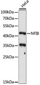 NFIB Antibody - Western blot analysis of extracts of HeLa cells, using NFIB antibody at 1:1000 dilution. The secondary antibody used was an HRP Goat Anti-Rabbit IgG (H+L) at 1:10000 dilution. Lysates were loaded 25ug per lane and 3% nonfat dry milk in TBST was used for blocking. An ECL Kit was used for detection and the exposure time was 120s.