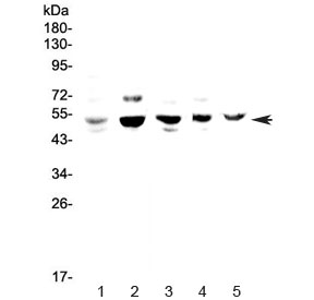 NFIB Antibody - Western blot testing of 1) human HeLa, 2) rat PC-12, 3) mouse lung, 4) mouse ovary and 5) mouse HEPA1-6 lysate with NFIB antibody at 0.5ug/ml. Predicted molecular weight ~47 kDa.