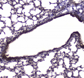 NFIB Antibody - IHC testing of FFPE mouse lung tissue with NFIB antibody at 1ug/ml. Required HIER: steam section in pH6 citrate buffer for 20 min and allow to cool prior to staining.
