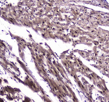 NFIB Antibody - IHC testing of FFPE rat heart tissue with NFIB antibody at 1ug/ml. Required HIER: steam section in pH6 citrate buffer for 20 min and allow to cool prior to staining.