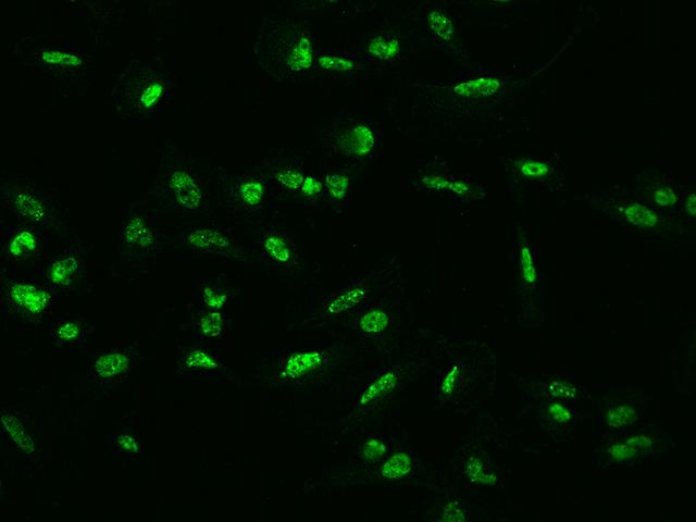 NFIB Antibody - Immunofluorescence staining of NFIB in U251MG cells. Cells were fixed with 4% PFA, permeabilzed with 0.3% Triton X-100 in PBS, blocked with 10% serum, and incubated with rabbit anti-Human NFIB polyclonal antibody (dilution ratio 1:200) at 4°C overnight. Then cells were stained with the Alexa Fluor 488-conjugated Goat Anti-rabbit IgG secondary antibody (green). Positive staining was localized to Nucleus.