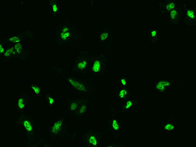 NFIB Antibody - Immunofluorescence staining of NFIB in U251MG cells. Cells were fixed with 4% PFA, permeabilzed with 0.1% Triton X-100 in PBS, blocked with 10% serum, and incubated with rabbit anti-Human NFIB polyclonal antibody (dilution ratio 1:200) at 4°C overnight. Then cells were stained with the Alexa Fluor 488-conjugated Goat Anti-rabbit IgG secondary antibody (green). Positive staining was localized to Nucleus.