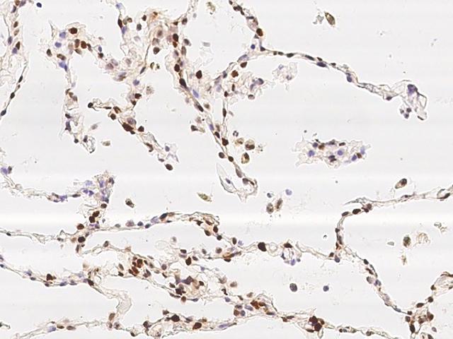 NFIB Antibody - Immunochemical staining of human NFIB in human lung with rabbit polyclonal antibody at 1:200 dilution, formalin-fixed paraffin embedded sections.