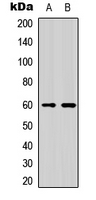 NFIL3 Antibody - Western blot analysis of NFIL3 expression in HeLa (A); K562 (B) whole cell lysates.