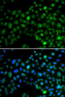 NFIL3 Antibody - Immunofluorescence analysis of MCF7 cells.