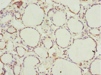 NFIL3 Antibody - Immunohistochemistry of paraffin-embedded human thyroid tissue at dilution 1:100