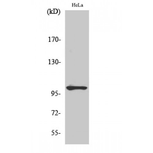 NFKB1 / NF-Kappa-B Antibody - Western blot of Phospho-NFkappaB-p105 (S907) antibody