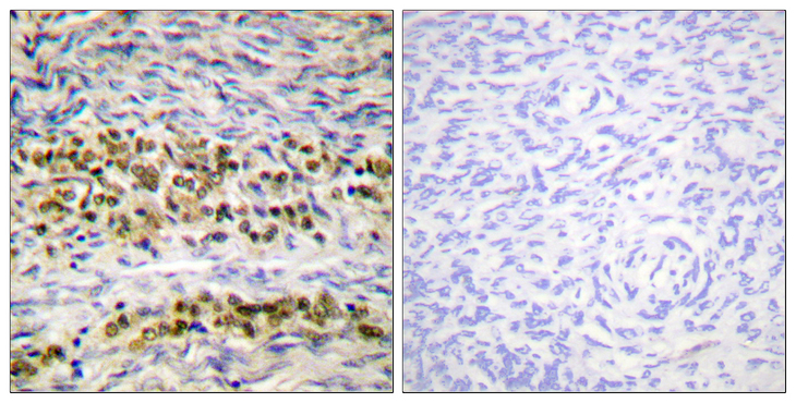NFKB1 / NF-Kappa-B Antibody - Immunohistochemistry analysis of paraffin-embedded human ovary tissue, using NF-kappaB p105/p50 Antibody. The picture on the right is blocked with the synthesized peptide.
