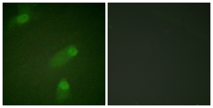 NFKB1 / NF-Kappa-B Antibody - Immunofluorescence analysis of HeLa cells, using NF-kappaB p105/p50 Antibody. The picture on the right is blocked with the synthesized peptide.