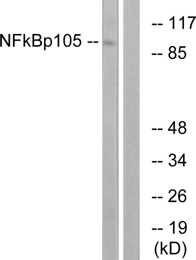 NFKB1 / NF-Kappa-B Antibody - Western blot analysis of lysates from HeLa cells, treated with CA+TNF 20ng/ml 10', using NF-kappaB p105/p50 Antibody. The lane on the right is blocked with the synthesized peptide.