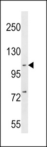 NFKB1 / NF-Kappa-B Antibody - NFKB(p105) Antibody (C-term S933) western blot of MDA-MB231 cell line lysates (35 ug/lane). The NFKB antibody detected the NFKB protein (arrow).