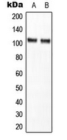 NFKB1 / NF-Kappa-B Antibody - Western blot analysis of NF-kappaB p105 expression in HT29 (A); K562 (B) whole cell lysates.