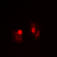 NFKB1 / NF-Kappa-B Antibody - Immunofluorescent analysis of NF-kappaB p105 staining in HeLa cells. Formalin-fixed cells were permeabilized with 0.1% Triton X-100 in TBS for 5-10 minutes and blocked with 3% BSA-PBS for 30 minutes at room temperature. Cells were probed with the primary antibody in 3% BSA-PBS and incubated overnight at 4 deg C in a humidified chamber. Cells were washed with PBST and incubated with a DyLight 594-conjugated secondary antibody (red) in PBS at room temperature in the dark. DAPI was used to stain the cell nuclei (blue).