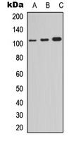 NFKB1 / NF-Kappa-B Antibody - Western blot analysis of NF-kappaB p105 (pS907) expression in HepG2 (A); HEK293T (B); HeLa (C) whole cell lysates.