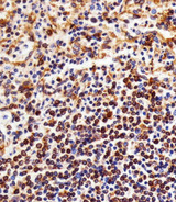 NFKB1 / NF-Kappa-B Antibody - Immunohistochemical of paraffin-embedded H. spleen section using NFKB1. Antibody was diluted at 1:25 dilution. A peroxidase-conjugated goat anti-rabbit IgG at 1:400 dilution was used as the secondary antibody, followed by DAB staining.