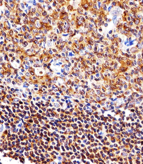 NFKB1 / NF-Kappa-B Antibody - Immunohistochemical of paraffin-embedded H. tonsil section using NFKB1. Antibody was diluted at 1:25 dilution. A peroxidase-conjugated goat anti-rabbit IgG at 1:400 dilution was used as the secondary antibody, followed by DAB staining.