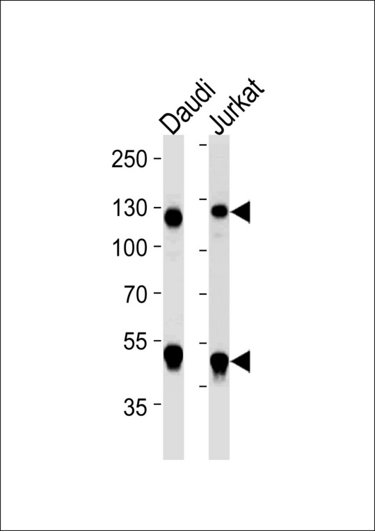 NFKB1 / NF-Kappa-B Antibody - Western blot of lysates from Daudi, Jurkat cell line (from left to right) with NFKB1 Antibody. Antibody was diluted at 1:1000 at each lane. A goat anti-mouse IgG H&L (HRP) at 1:5000 dilution was used as the secondary antibody. Lysates at 35 ug per lane.