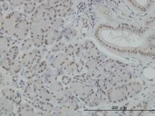 NFKB1 / NF-Kappa-B Antibody - Immunoperoxidase of monoclonal antibody to NFKB1 on formalin-fixed paraffin-embedded human salivary gland. [antibody concentration 3 ug/ml]