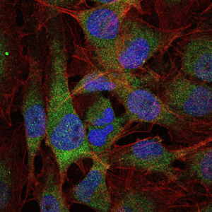 NFKB1 / NF-Kappa-B Antibody - Immunofluorescence of U251 cells using NFKB1 mouse monoclonal antibody (green). Blue: DRAQ5 fluorescent DNA dye. Red: Actin filaments have been labeled with Alexa Fluor-555 phalloidin.